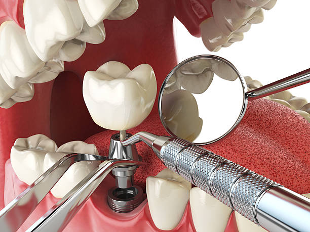 Best Walk-In Emergency Dental Services in Twin Grove, IL